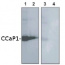 AtCCaP1 | vacuolar calcium-binding protein-related